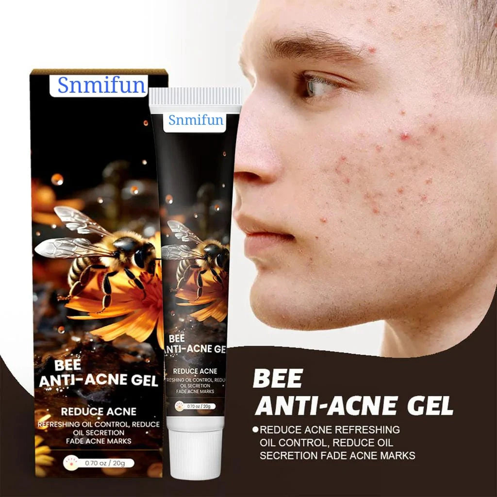 Bee Acne Gel – Natural Pimple Treatment