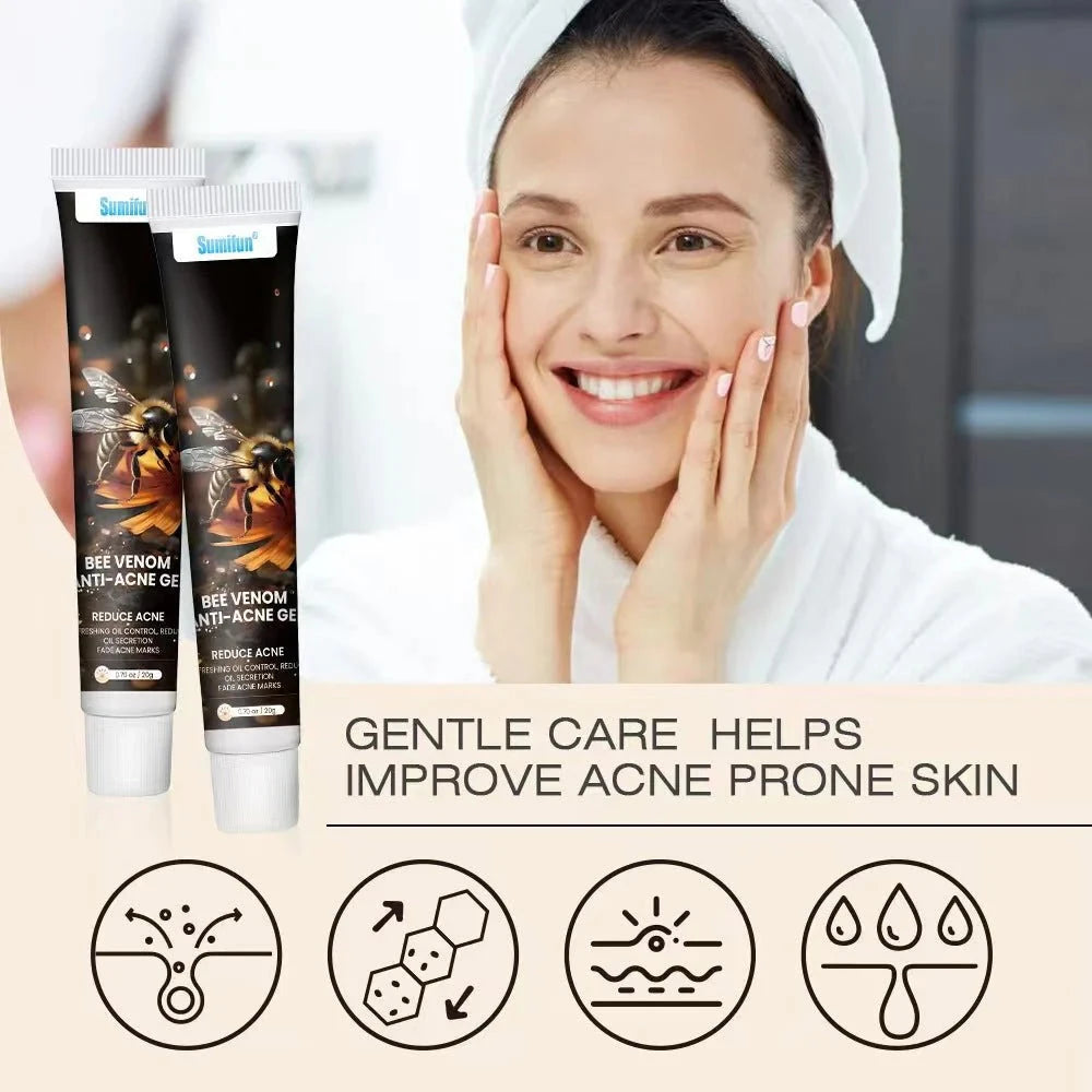Bee Acne Gel – Natural Pimple Treatment